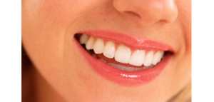 Cosmetic dentistry